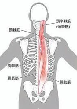 背中の痛みの原因になりやすい筋肉